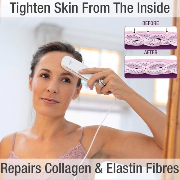 Silk'n Titan Anti Aging Skin Tightening Device - Picture 4 of 7